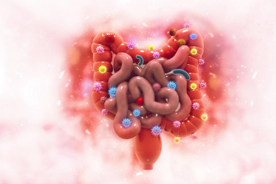 Cancer attacking bowel cells