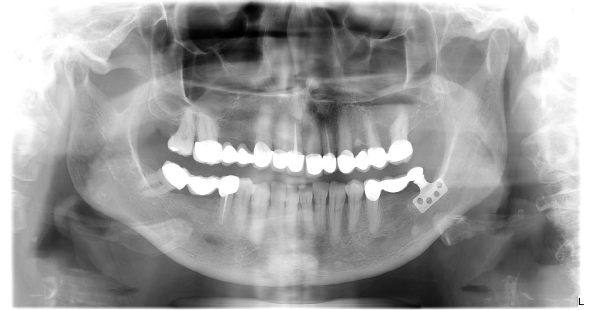 The 40 years history of dental implantation at the S and Z Beautiful