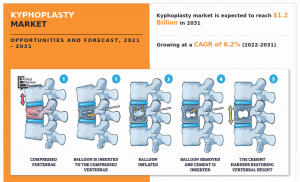 Kyphoplasty Market, 2035