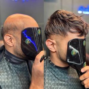 Hair System Maintenance Before After - Touch Up NYC