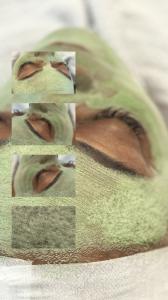 Professional skincare treatment and chemical peel at Allegria Spa