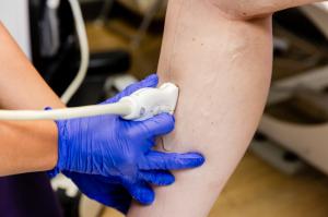 Clinician performing a diagnostic leg ultrasound to assess vein health at Polaris Vein & Aesthetics.