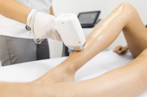 Laser Hair Removal Surfside, FL