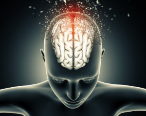 brain therapy for stress relief in Red Deer