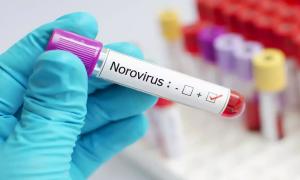 Norovirus Diagnostics Market