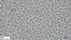 HDLM-2 is a Hodgkin-Lymphom cell line, source: DSMZ