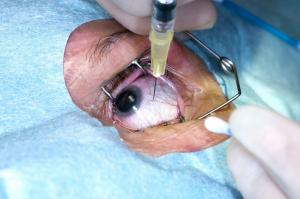 Anti-Vascular Endothelial Growth Factor (Anti-VEGF) market