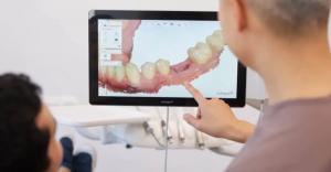 Dental Implants Procedure by Dr Kent