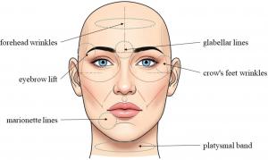 Botulinum Toxin Market