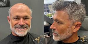 Non-surgical hair replacement before and after for men at Fidenza Hair Co. San Diego studio.