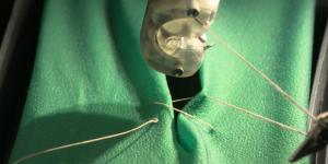 automated suturing devices market