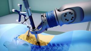 spine surgery robots market