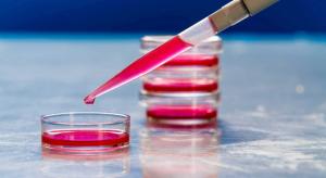 cell culture media market