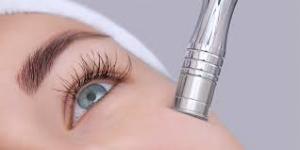 microdermabrasion devices market