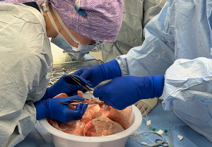 Perfusion Solution clinicians