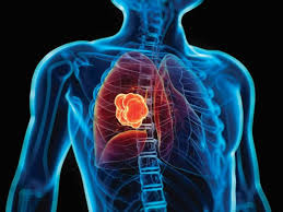 interventional oncology market