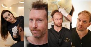 Sule Hair Transplant