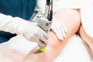 Laser Hair Removal Treatement at Dvida Spa near Raleigh