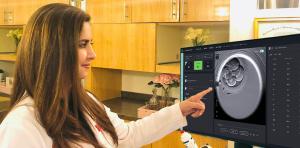 Dr. Hosseinzadeh reviewing a healthy embryo on the Chloe AI interface, highlighting real-time, data-driven embryo assessment during Precision IVF.