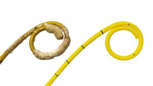 Uncoated and coated ureteral stent