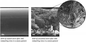 SEM of coated and uncoated ureteral stent