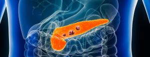 pancreatic cancer treatment market