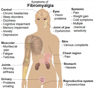 fibromyalgia treatment market