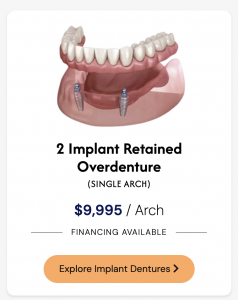2 Implant Retained Overdenture Boynton Beach, FL