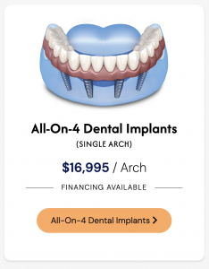 All-On-4 Dental Implants Boynton Beach, FL