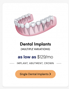Dental Implants Boynton Beach, FL
