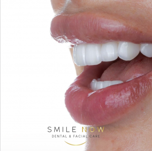 Premium dental services Smile design veneers at SMILE NOW in Cancun for dental tourism