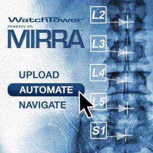 Captiva Spine – WatchTower Spine Navigation System powered by MIRRA.