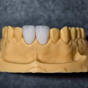 Sunflower Dental Lab - Product Portfolio Where Artistry Meets Engineering