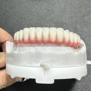 Sunflower Dental Lab - Implant Restorations Engineering Stability