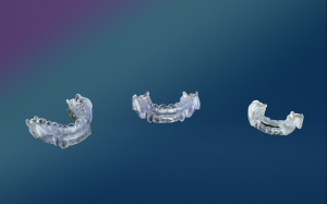 AIO Breathe treats sleep apnea in children and teenagers