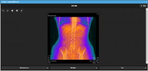 DICOM image with colored filter applied