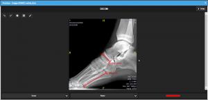 preview of a DICOM image (foot) with rulers to measure distances