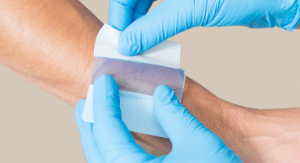 advanced wound dressing market