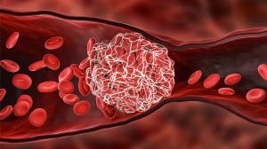 venous thromboembolism treatment market
