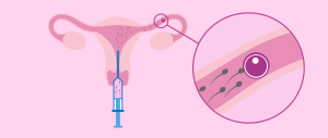 artificial insemination (AI) market