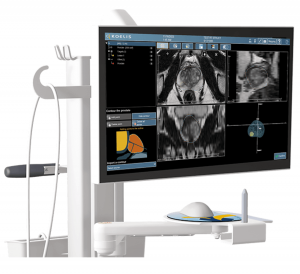 MRI fusion prostate ultrasound