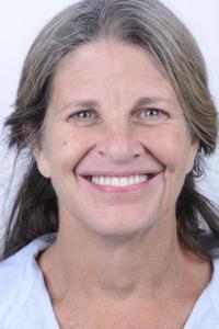 Catherine Osborne smiling post surgery