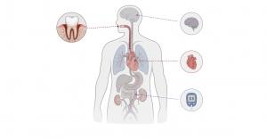Infographic showing connections between periodontal disease and the brain, heart, and pancreas through inflammatory pathways.