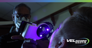 Dental clinician using the VELscope Mantis to perform an adjunctive oral cancer screening on a patient