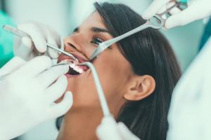 dental-check-up-in-clinic-P9XPURT-xl