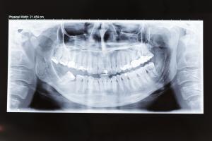 x-ray-Q4FT7WV-xl