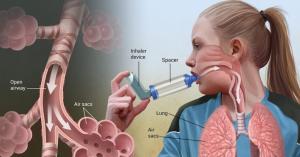 Asthma Treatment Market1