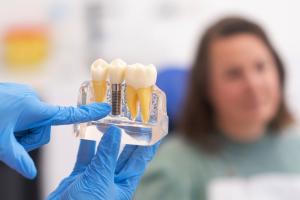Dental Implants-galway-dentists-H91ERP4-69