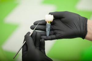 Dental Implants-galway-dentists-H91ERP4-79