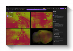 Allen Institute using NeuroGlass by MetaCell to support large-scale brain imaging workflows